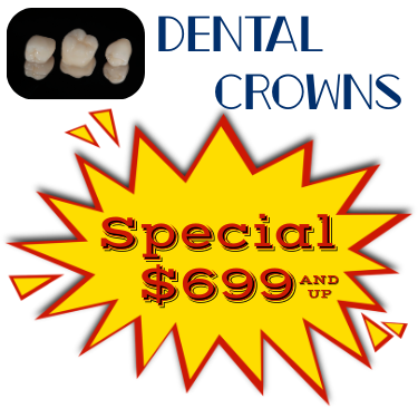 Dental Crown Special in Tempe | Digital Dental Solutions