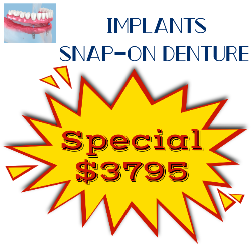 Snap-On Denture Special in Tempe | Digital Dental Solutions
