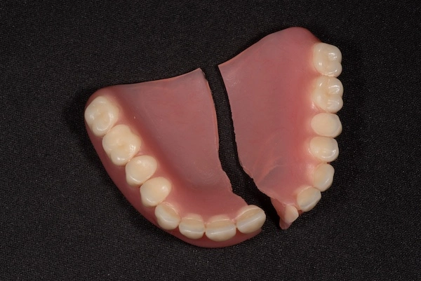 Broken Denture in Tempe | Denture Repair in Tempe